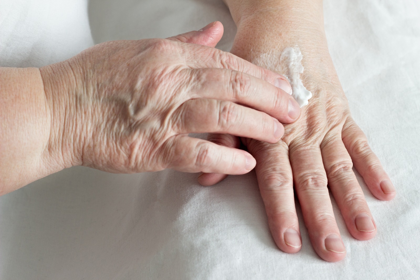 Pommade médicale anti escarres pour les personnes âgées, que faut-il savoir ?